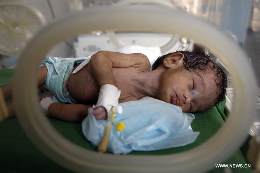 الصورة : تأثير الصراعات على الأطفال حديثي الولادة في اليمن 