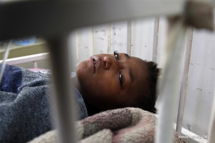 الصورة : تفشي سوء التغذية بين أطفال اليمن 