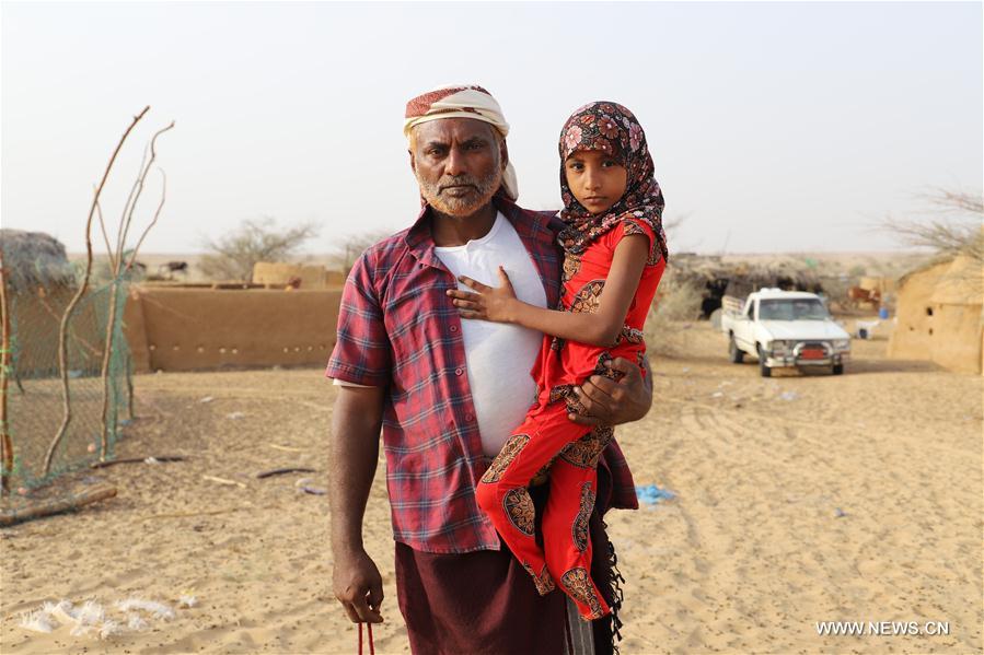الصورة: ضحايا الألغام في اليمن 