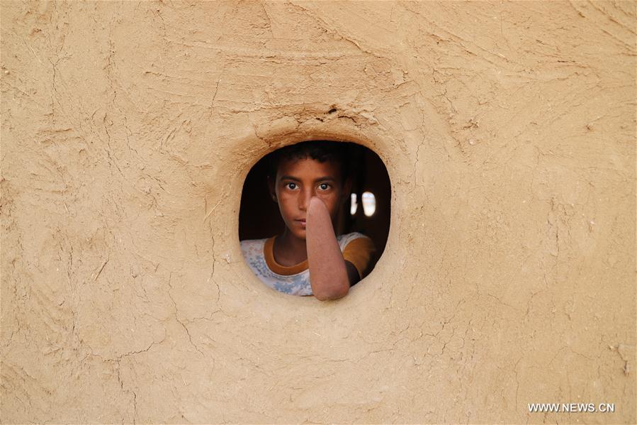 الصورة: ضحايا الألغام في اليمن 