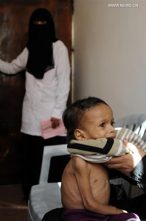 الصورة: اليمن يواجه أزمة إنسانية متفاقمة بسبب الحرب