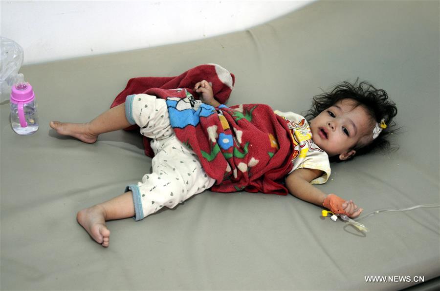 الصورة: 300 ألف إصابة بالكوليرا في اليمن