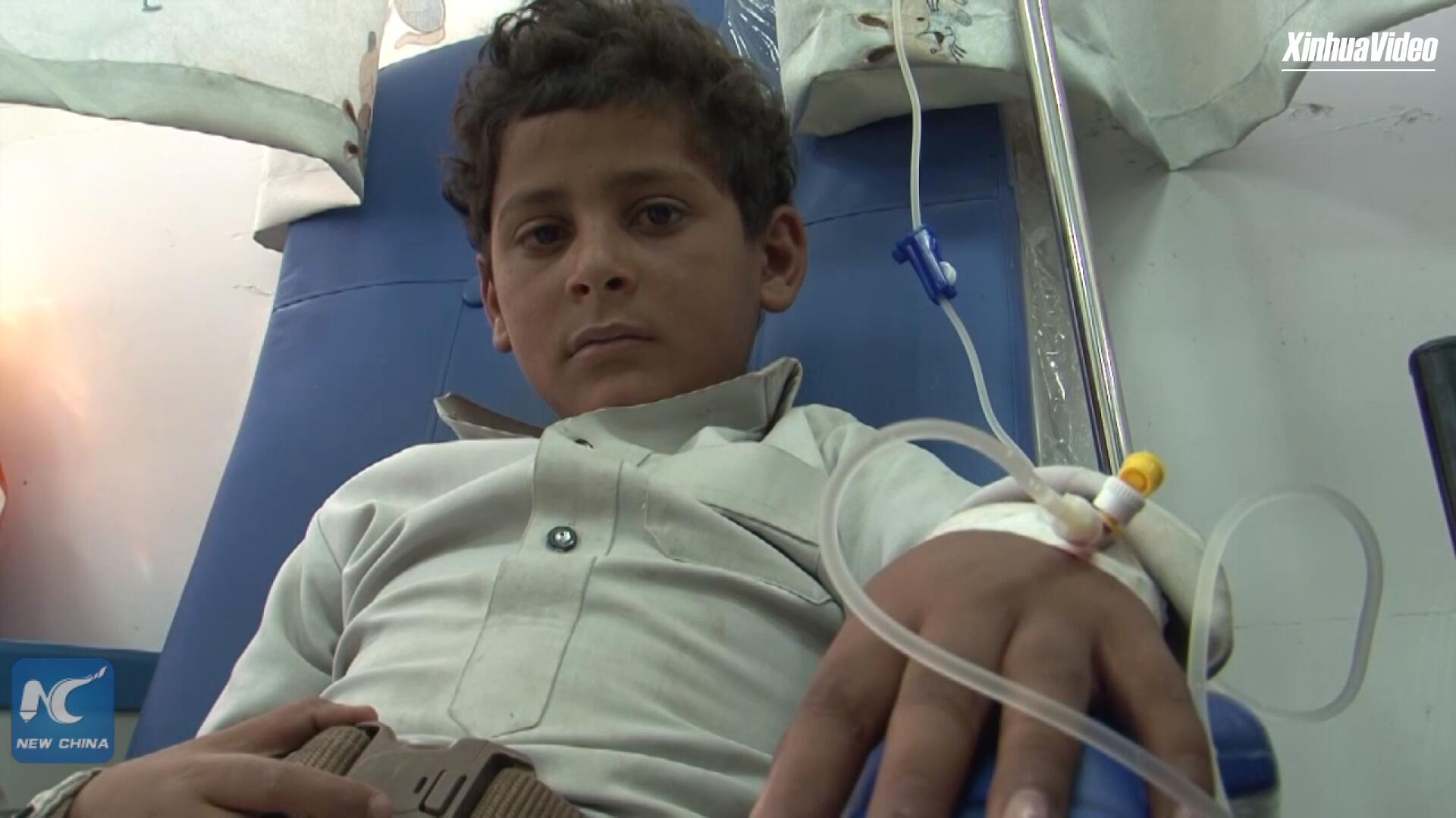 فيديو: الأطفال المصابون بالسرطان في اليمن في حاجة ماسة للمساعدة