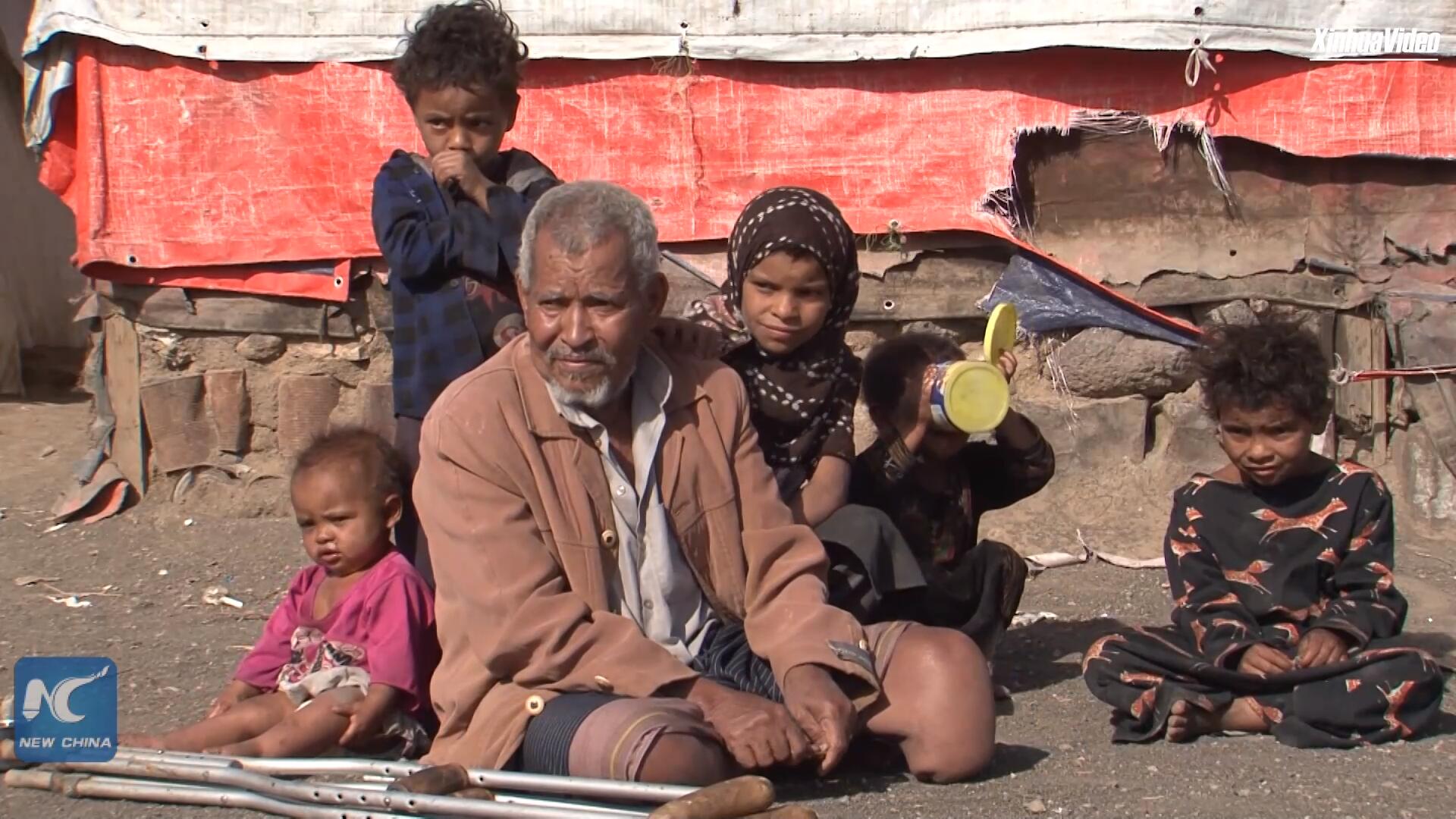 فيديو: استمرار تفاقم معاناة النازحين داخليا في المعسكرات اليمنية