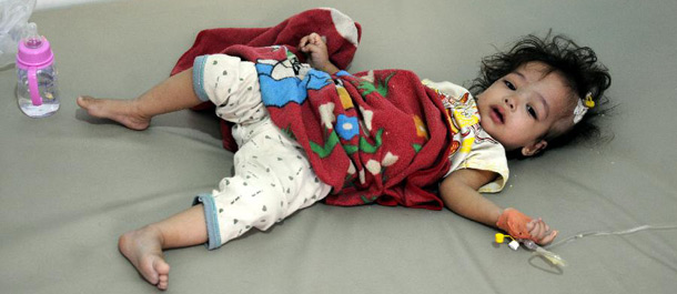 300 ألف إصابة بالكوليرا في اليمن