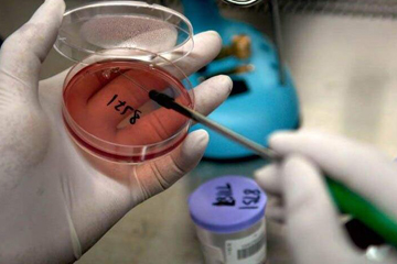 علماء في سويسرا يكتشفون وجود "حاسة اللمس" عند البكتيريا