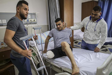 فلسطيني بترت ساقه بعد إصابته بطلق ناري متفجر على يد القوات الإسرائيلية على حدود غزة